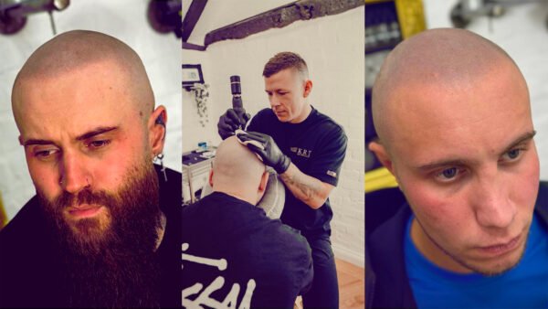 Scalp micropigmentation · Kristian Raine-Thrall