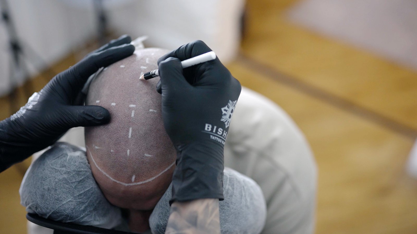 Scalp Micro Pigmentation (SMP)
