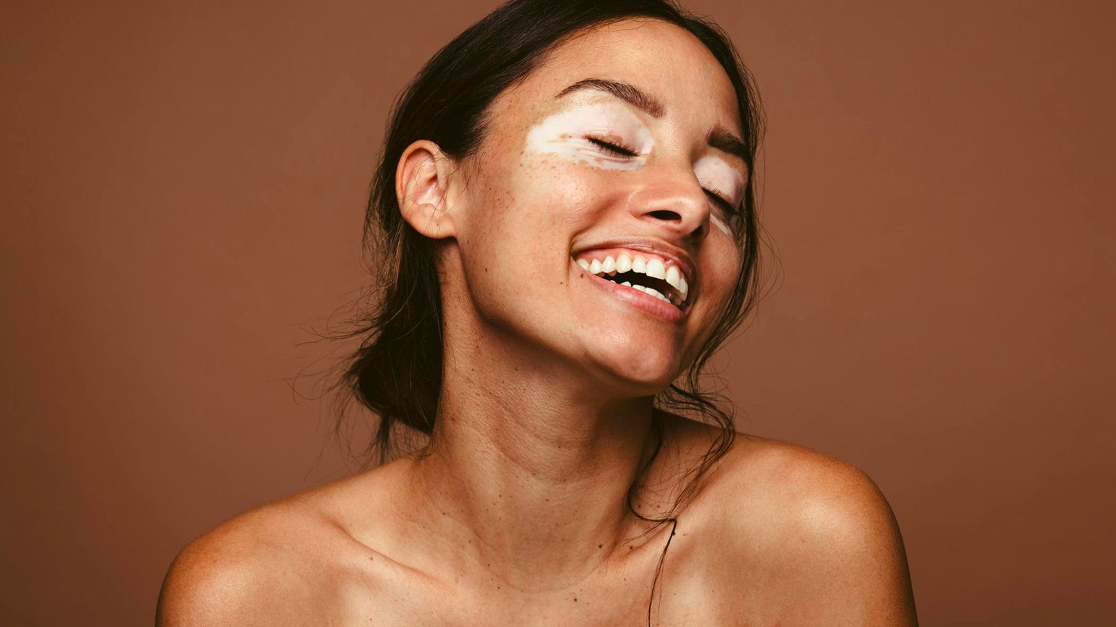 Vitiligo cover-up