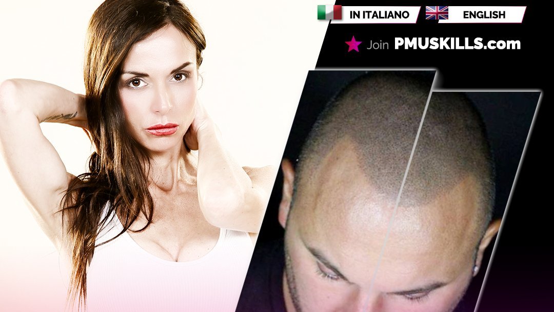 Scalp Micropigmentation – Masterclass with Alessia Di Carlo