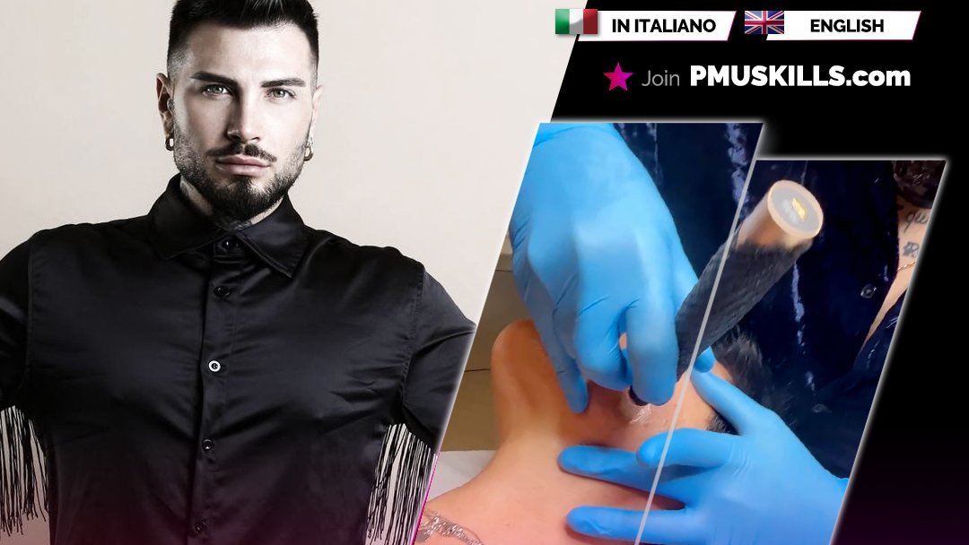 Needling, rimozione delle macchie del viso – Masterclass con Patrick Picello